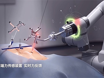 骨科手术机器人